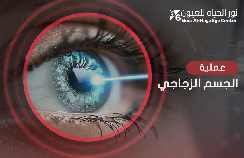 عملية الجسم الزجاجي