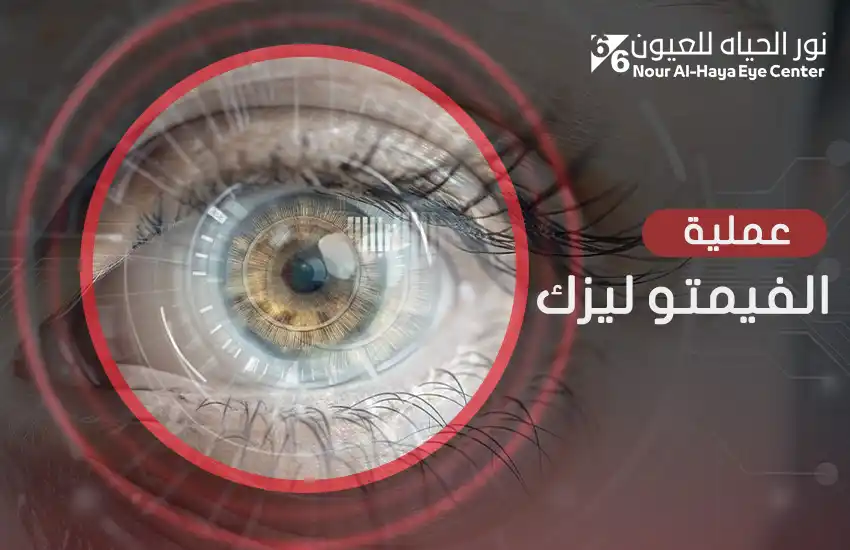 عملية الفيمتو ليزك