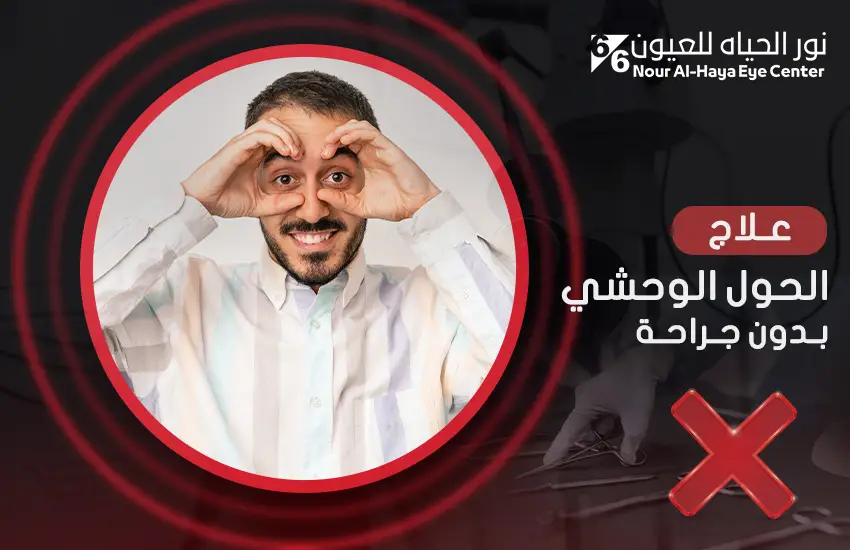 علاج-الحول-الوحشي-بدون-جراحة علاج الحول الوحشي بدون جراحة