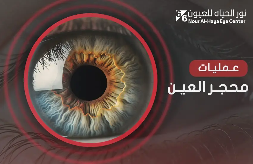 عمليات محجر العين