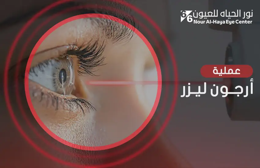 عملية-ارجون-ليزر عملية أرجون ليزر