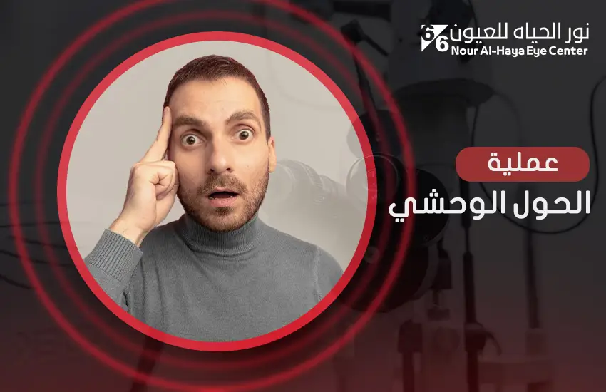 عملية الحول الوحشي