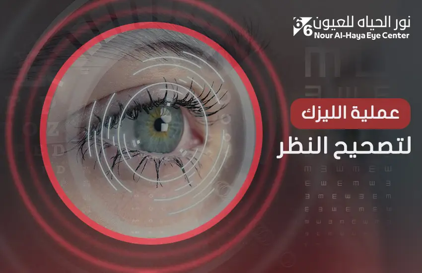 عملية الليزك لتصحيح النظر