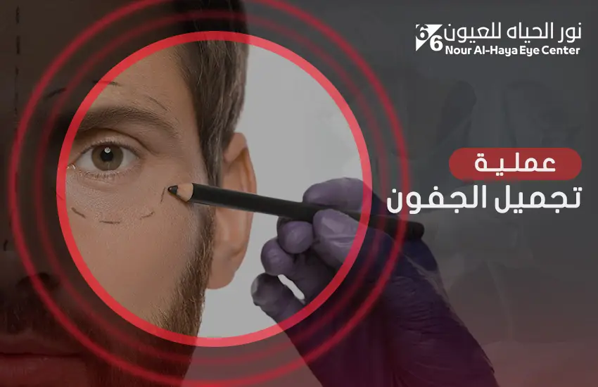 عملية تجميل الجفون