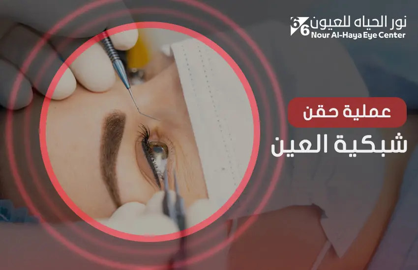 عملية حقن شبكية العين