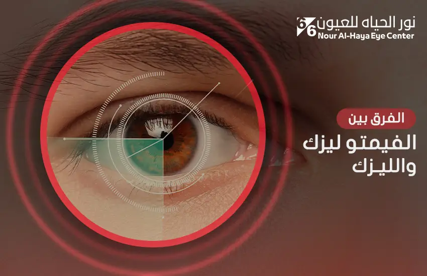 الفرق بين الفيمتو ليزك والليزك