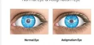 قرنية العين بالصور