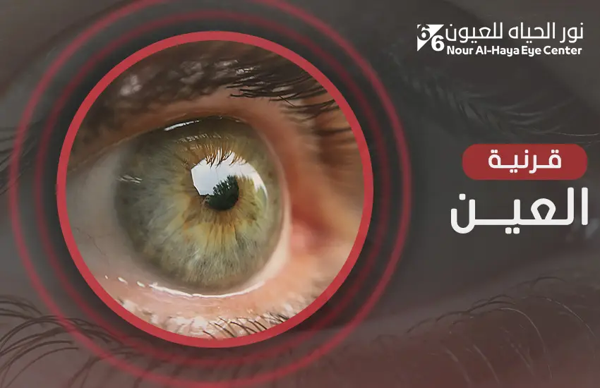 قرنية العين بالصور
