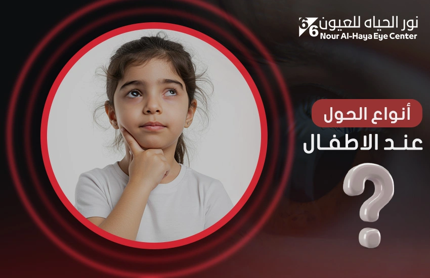 أنواع الحول عند الأطفال