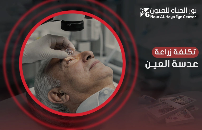 تكلفة زراعة عدسة العين