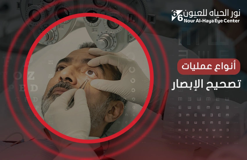 أنواع عمليات تصحيح الإبصار