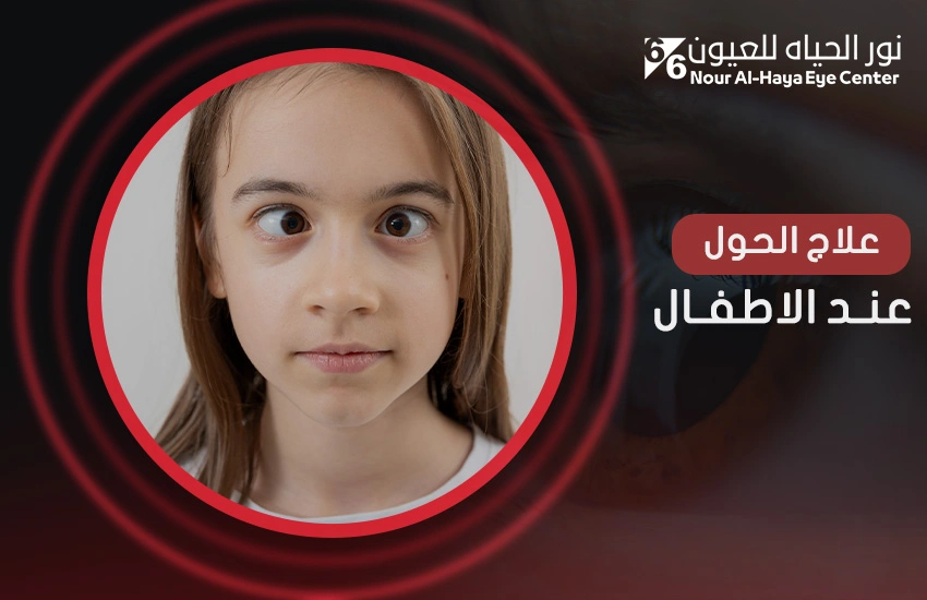 علاج الحول عند الأطفال