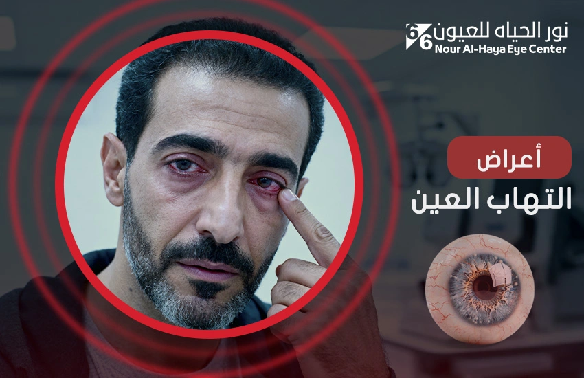 أعراض التهاب العين