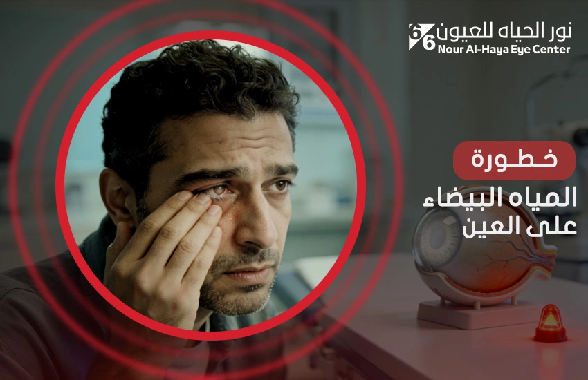 خطورة المياه البيضاء على العين والعوامل التي تزيد من حدتها