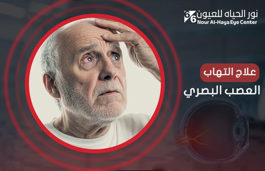 سُبل علاج التهاب العصب البصري المتاحة في مصر