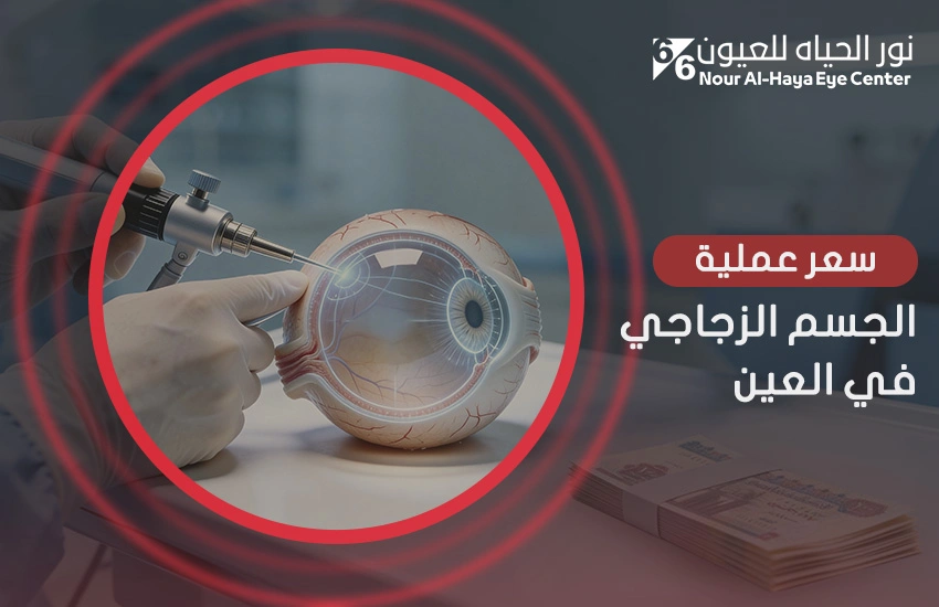 سعر عملية الجسم الزجاجي في العين والعوامل المؤثرة فيه