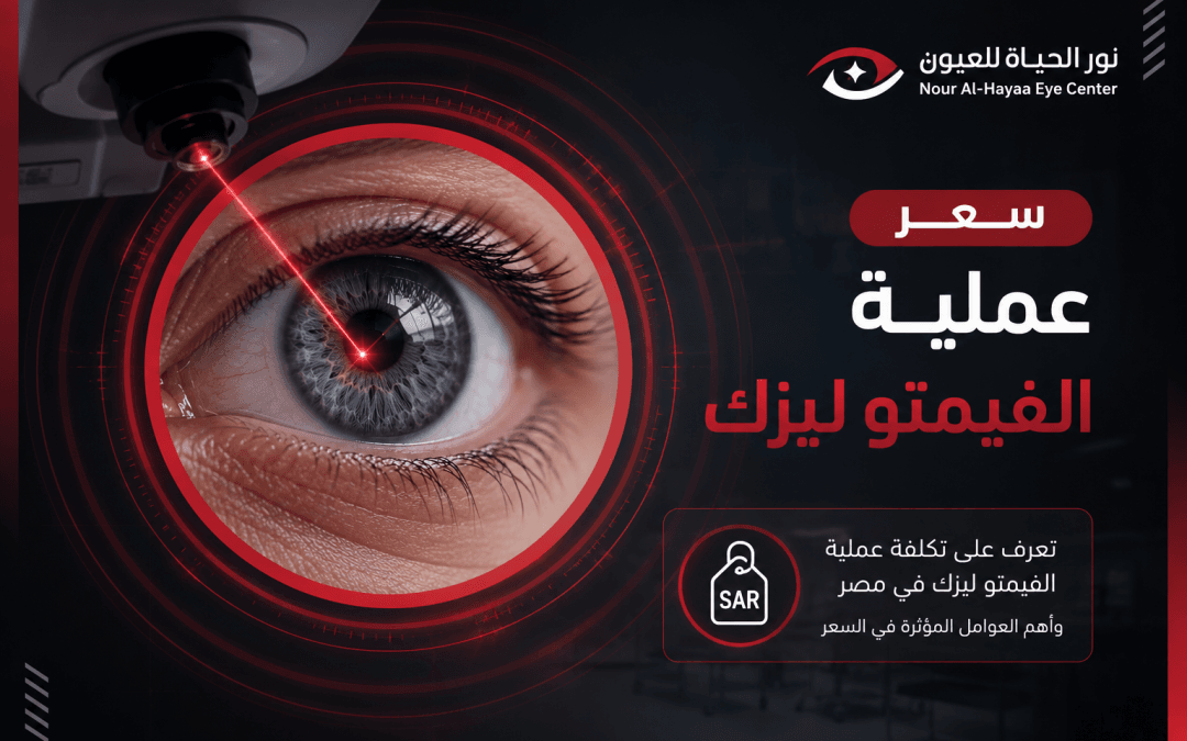 سعر عملية الفيمتو ليزك في مصر 2026