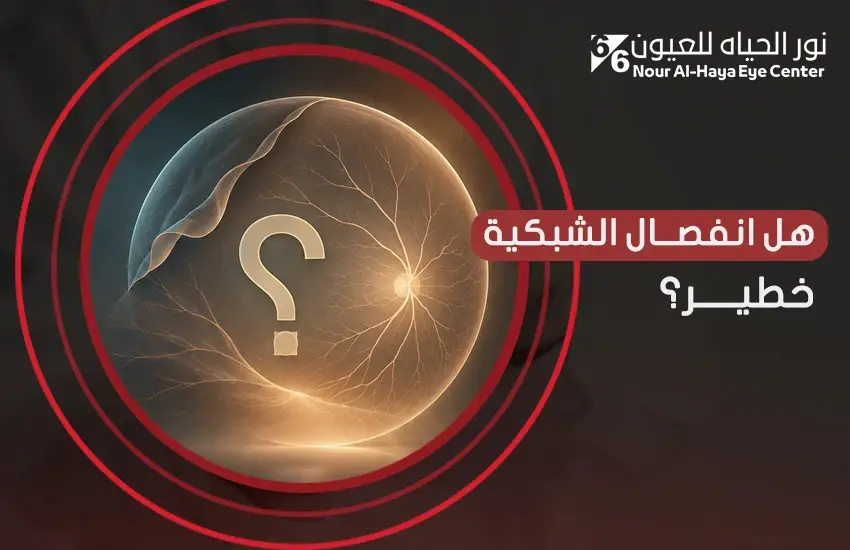هل انفصال الشبكية خطير؟ وما سُبل الوقاية من الإصابة؟