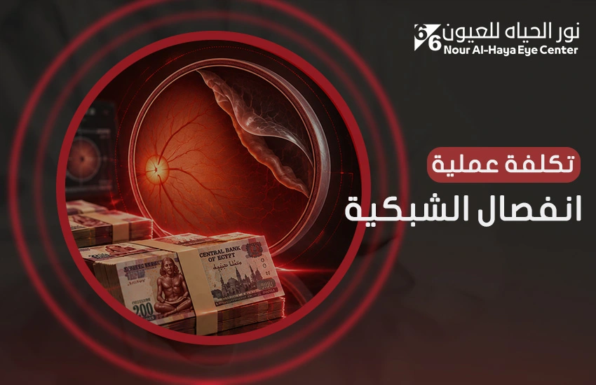 تكلفة عملية انفصال الشبكية في مصر وأهم العوامل المؤثرة فيها