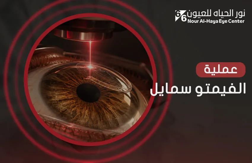خطوات عملية الفيمتو سمايل والنتائج من الإجراء